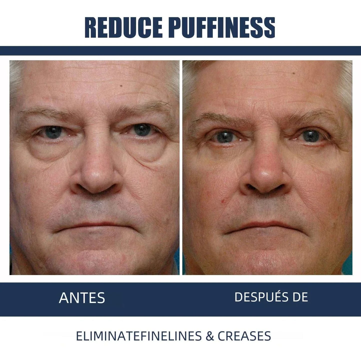 before and after images showing reduced puffiness and fine lines using East Moon Retinol Eye Cream