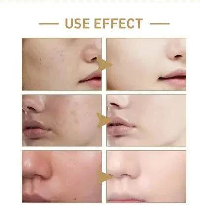 Rice Face Toner hydrating and brightening skin before and after results showing improved texture and glow
