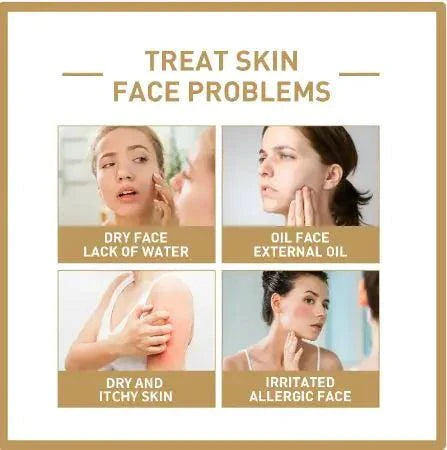Rice Face Toner hydrating and brightening skincare for dry, oily, itchy, and irritated skin types