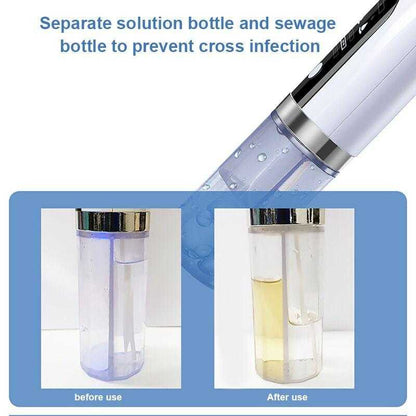 Electric Blackhead Vacuum Remover
